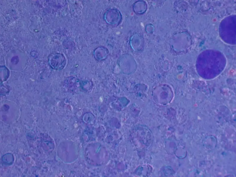 LG's New Wallpaper TV Is So Thin, It's Basically Invisible - Professional coverage